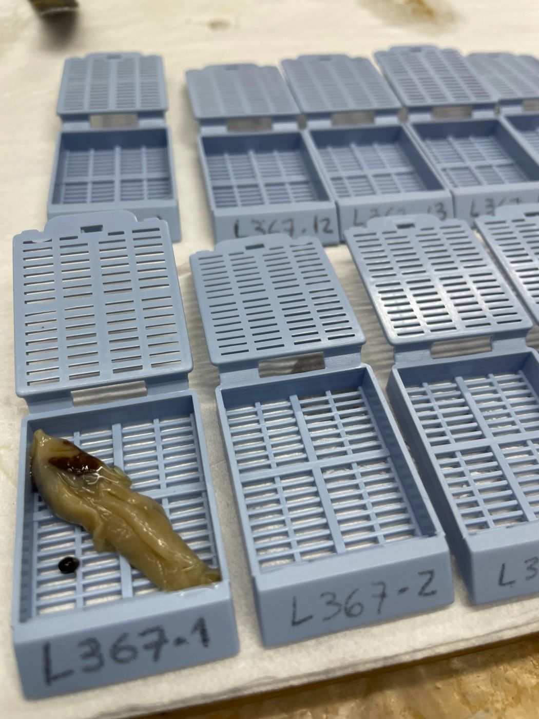 Casetes de histología numerados; en el primero, el tejido de una ostra listo para procesar.
